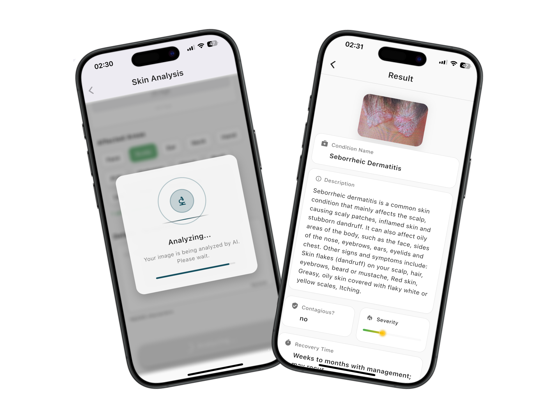DermAI App Screenshot